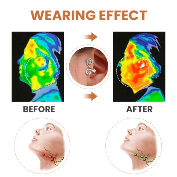 Lumiere™ Ears Acupressure Slimming Earrings