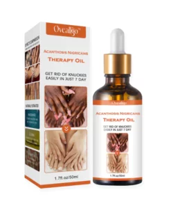 Oveallgo™ Acanthosis Nigricans Therapy Oil