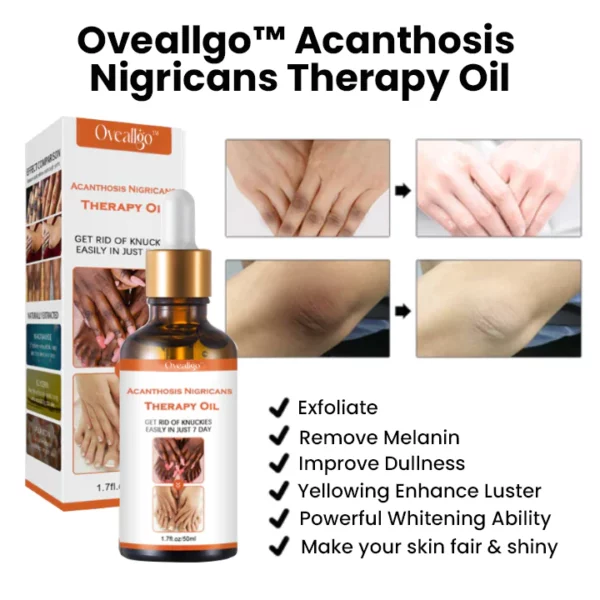 Oveallgo™ Acanthosis Nigricans Therapy Oil - Image 4