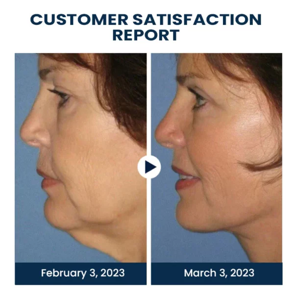 Oveallgo™ EMSPulse V-Face Sculpting Device - Image 5