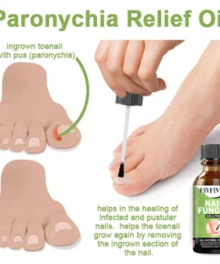 Oveallgo™ FootCure Removal Paronychia Gel