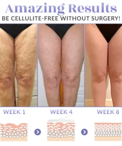 SKINNIER Tightening & Cellulite-Reducing Thigh Patch