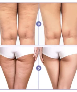 SKINNIER Tightening & Cellulite-Reducing Thigh Patch