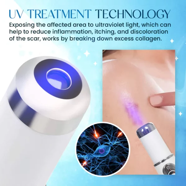 ScarErase™ UV Phototherapy Scar Removal Pen - Image 5