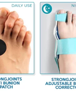 StrongJoints Adjustable Bunion Corrector