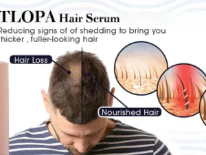 TLOPA Hair Serum