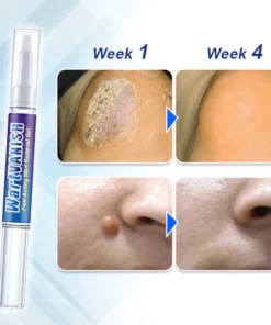 WartVanish™ Fast-Acting Wart Removal Gel