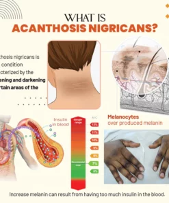 Zakdavi™ Acanthosis Nigricans Therapy Oil