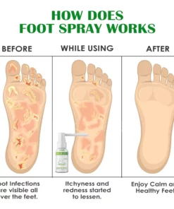 ATTDX FreshFeet Debacteria Botanical Spray