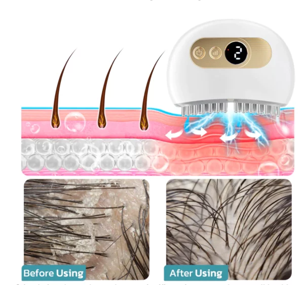 GFOUK™ EMS Nourishing Scalp Acupoint Massage Device - Image 3