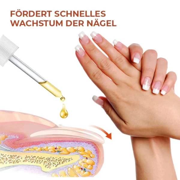 Oveallgo™ 7 Tage Maximale Stärke Nagel-Reparatur-Serum - Image 2