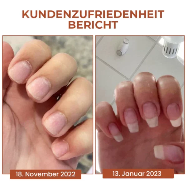 Oveallgo™ 7 Tage Maximale Stärke Nagel-Reparatur-Serum - Image 5