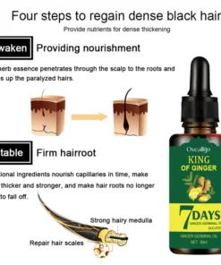 Oveallgo™ Shouga Kingu Hair Growth Oil