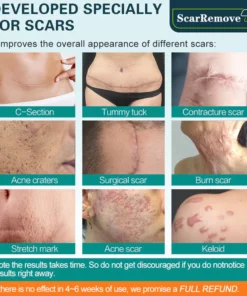 ScarRemove™ Advanced Scar Removal Spray