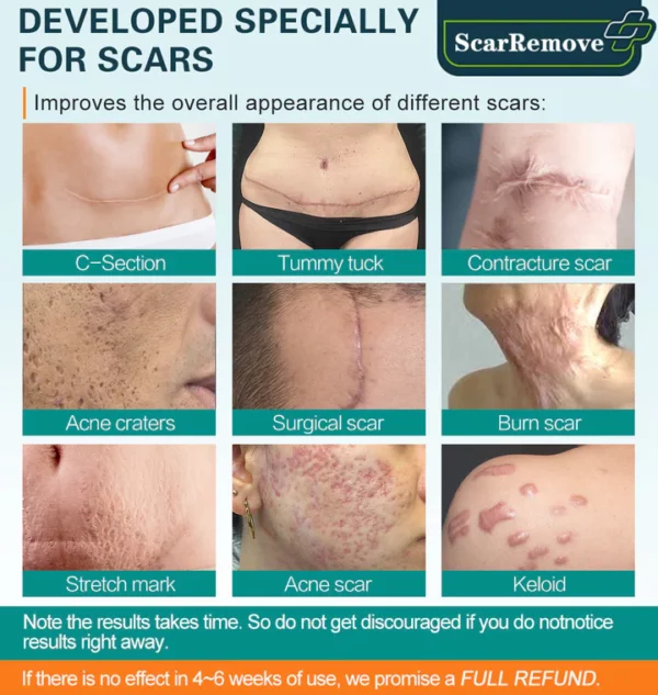 ScarRemove™ Advanced Scar Removal Spray