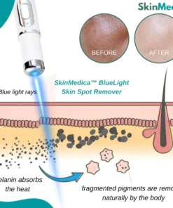 SkinMedica™ BlueLight Skin Spot Remover