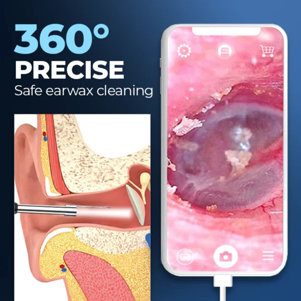 ViewScan™ Visible Earwax Cleaning Otoscope - Image 4