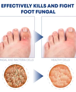 ATTDX FootCare AntiFungal HerbalBath Treatment