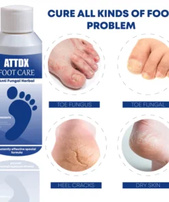 ATTDX FootCare AntiFungal HerbalBath Treatment