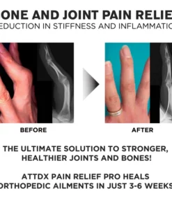 ATTDX PainRelief Pro JointRecovery Therapy Cream