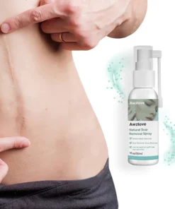 Awzlove™ Natural Scar Removal Spray