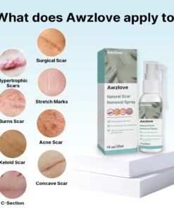 Awzlove™ Natural Scar Removal Spray