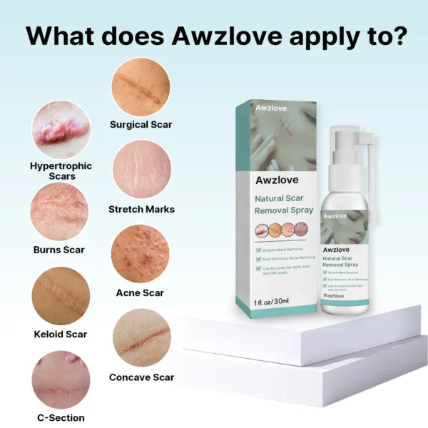 Awzlove™ Natural Scar Removal Spray