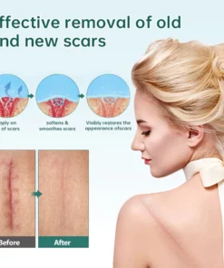 Awzlove™ Natural Scar Removal Spray