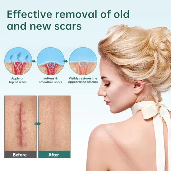 Awzlove™ Natural Scar Removal Spray