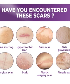 BIOCLEAR™ Silicone Scar Reduction Sheets