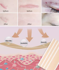 BIOCLEAR™ Silicone Scar Reduction Sheets