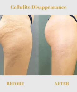 BootyPor™ Collagen Buttock Enlargement Patch