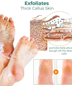 CC™ Foot Callus Removal Spray