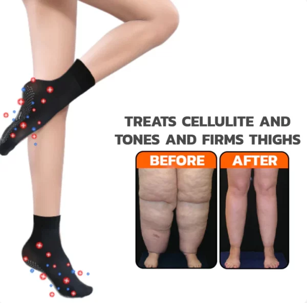 CC™ Tourmaline Ionic Body Shaping Stretch Socks - Image 8