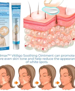 CC™ Vitiligo Soothing Ointment