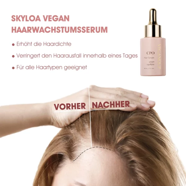 CPO™ Fᴏlliᴋel-Nährserum für Haarwuchs - Image 3