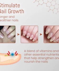 Ceoerty™ Nail Nourishing Growth Serum