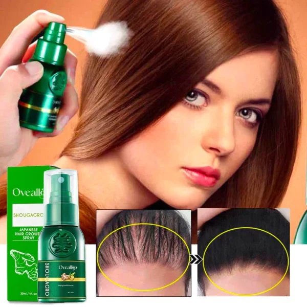 KL ShougaGRO Japanese Hair Growth Spray