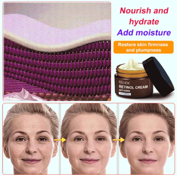 Retinol Anti Aging Wrinkle Removal Skin Firming Cream