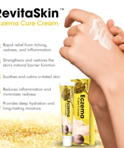 RevitaSkin™ Eczema Cure Cream