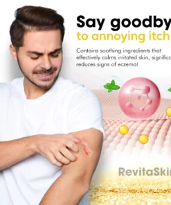 RevitaSkin™ Eczema Cure Cream