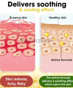 RevitaSkin™ Eczema Cure Cream