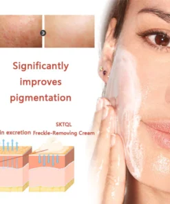 SKTQL™ Freckle-Removing Cream