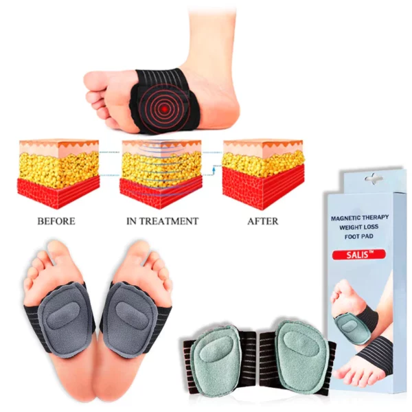 Salis™ Bubbling Spring Acupoint Magnetic Therapy Massage Weight Loss Forefoot Pad - Image 3