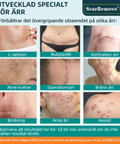 ScarRemove™ Avancerad Ärrspray