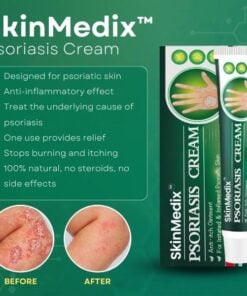 SkinMedix™ Psoriasis Cream