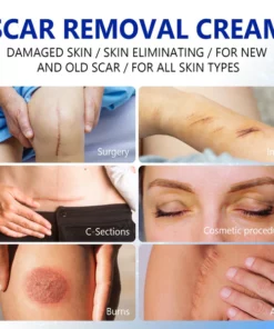 SkinRevive™ Advanced scar cream