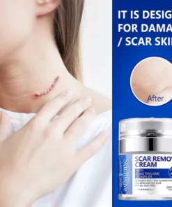 SkinRevive™ Advanced scar cream