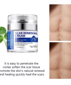 SkinRevive™ Advanced scar cream