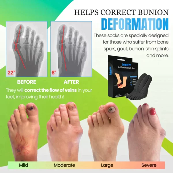 Anti-Bunions Health Socks - Image 3